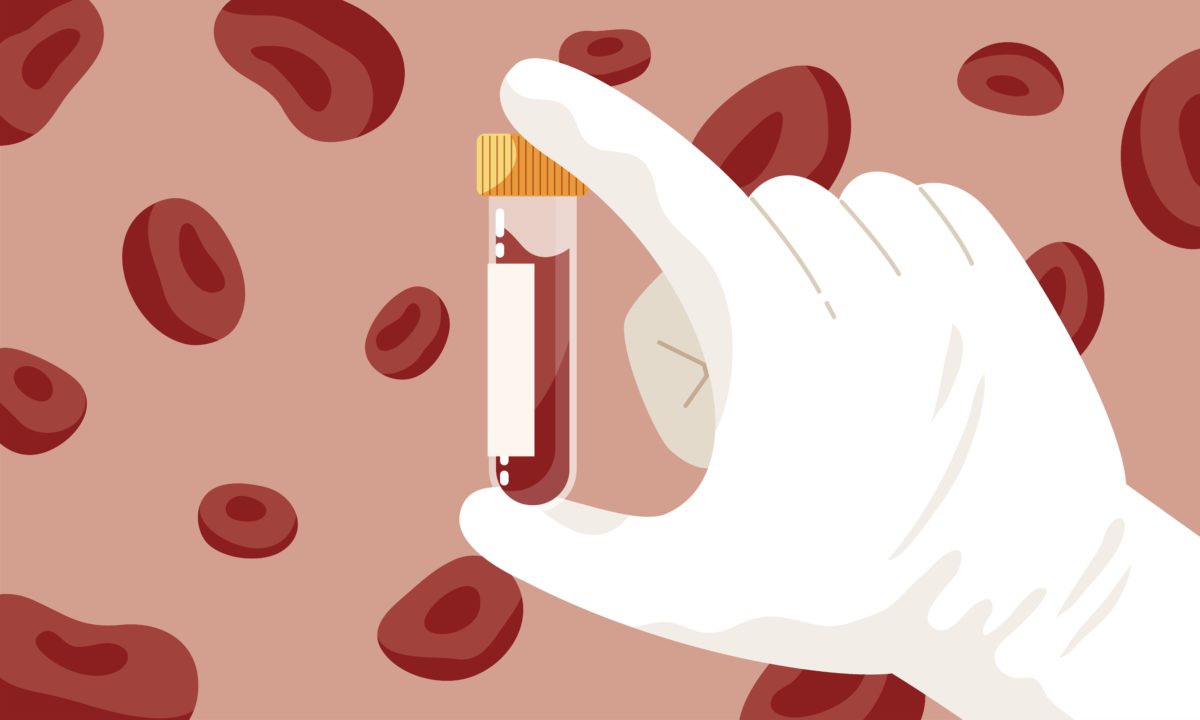 What Can A Blood Test Reveal About Your Hormones?