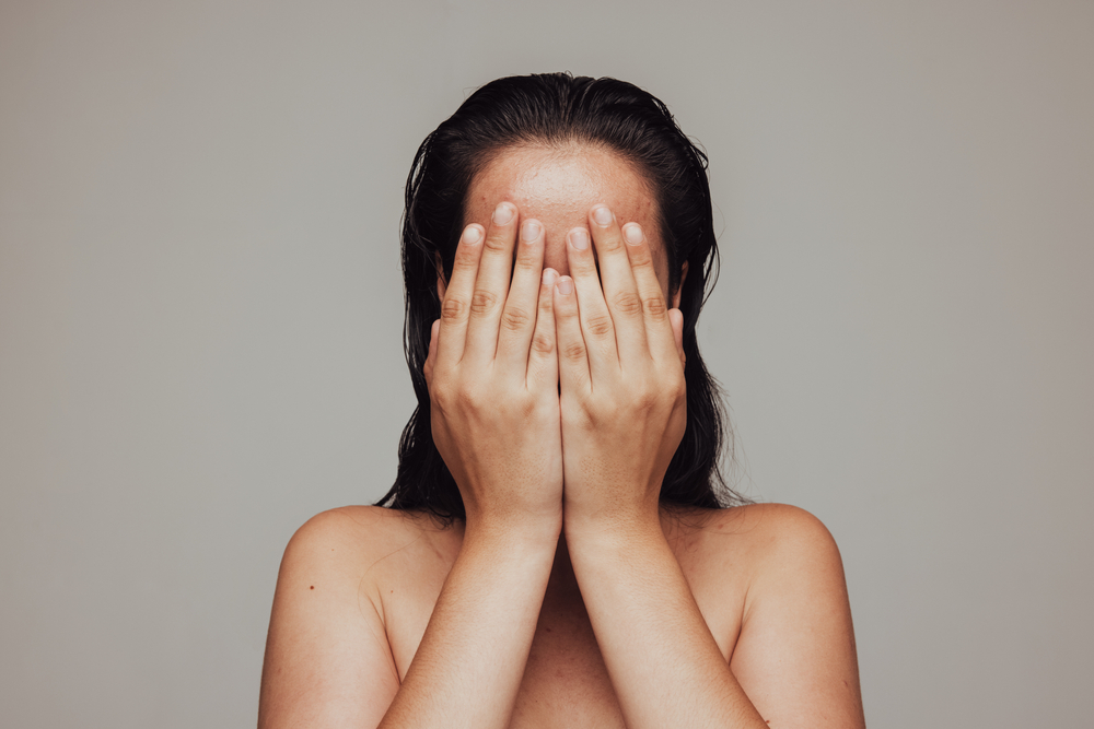 What To Do When… You’ve Reacted to New Skincare